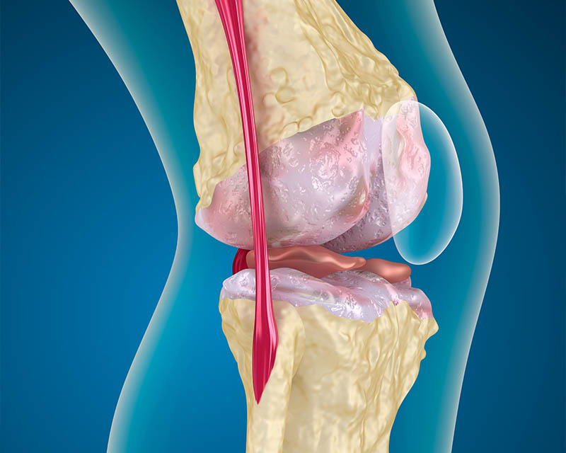 探索骨质疏松症的秘密